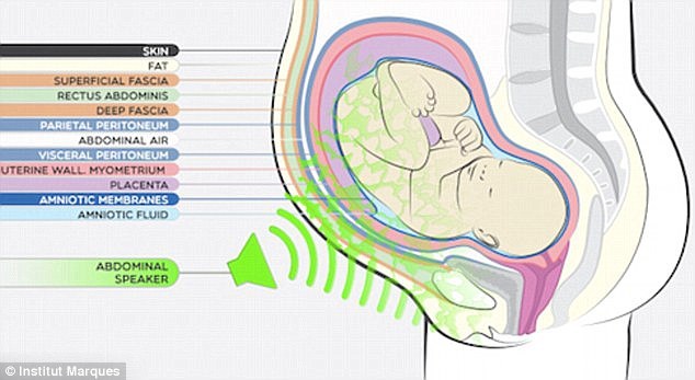 脑洞大开的孕妇音箱:阴道中向胎儿播放