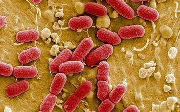 一般认为该菌群细菌可包括大肠埃希氏菌,柠檬酸杆菌,产气克雷白氏菌和