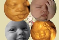 胎儿的四维彩超影像与宝宝出生后的照片，是不是很像