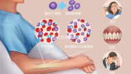 江西省儿童医院：孩子身上出现这几个信号需警惕白血病